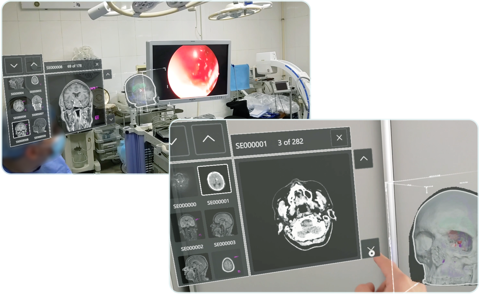 Extra Vision Crossplatform Compatibility