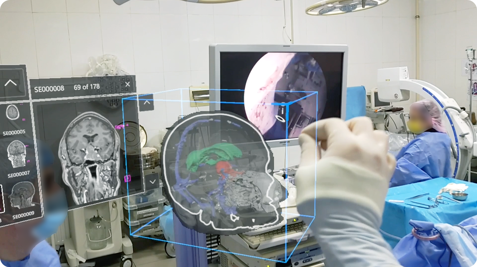 Extra Vision Local Rendering