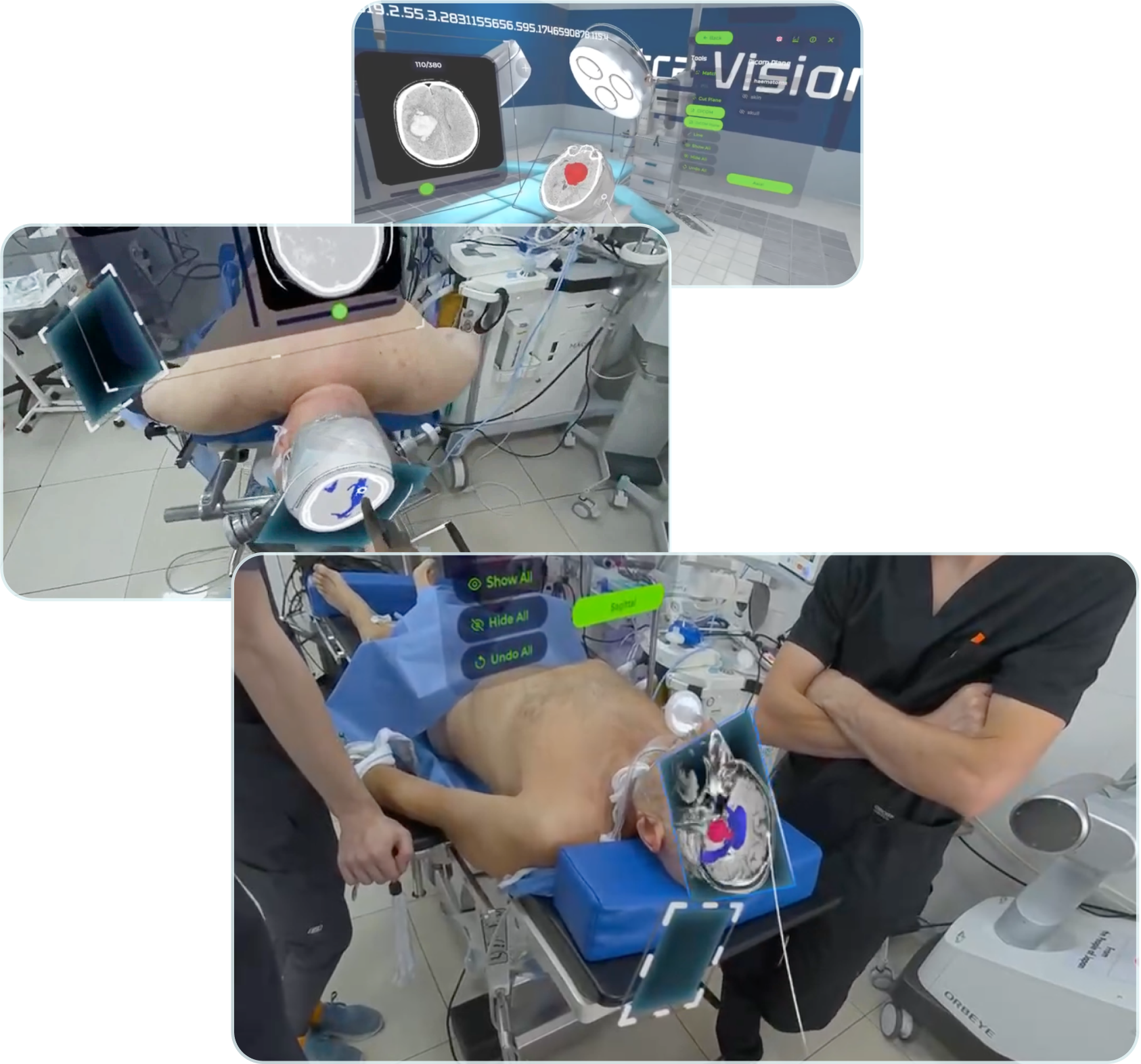 Extra Vision Solution