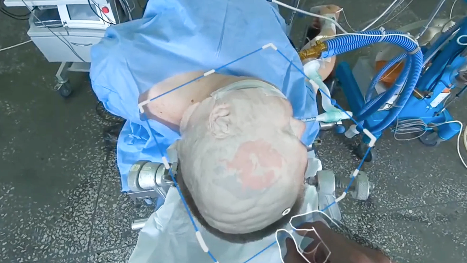 Extra Vision Real-Time AR 3D Model Alignment